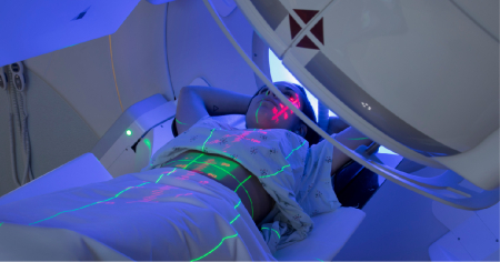 Demystifying Radiation Therapy in Early-Stage Breast Cancer