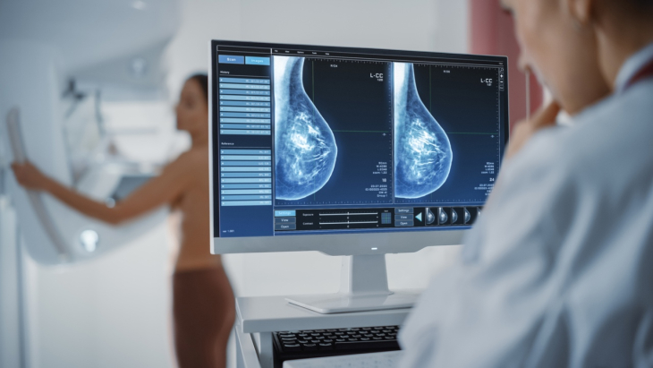 Understanding Breast Density: What It Is and Why It Matters